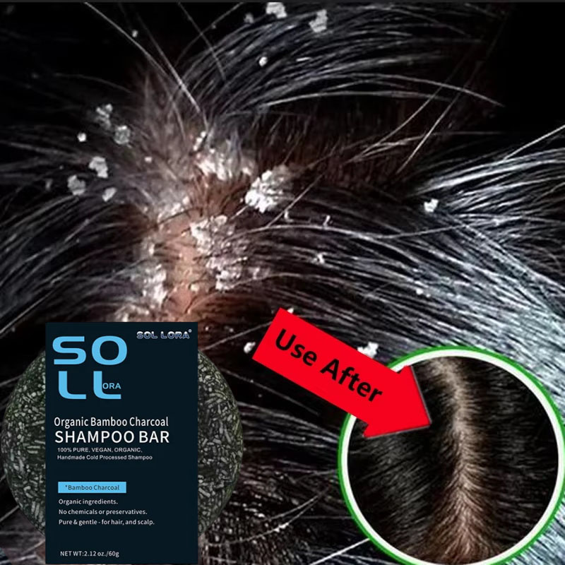 Hair Care Dandruff - Быстрое средство против перхоти, мыло для