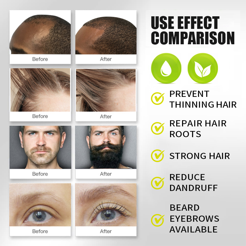 Масло для быстрого роста волос – обзор и цена Hair Care Vitamin E