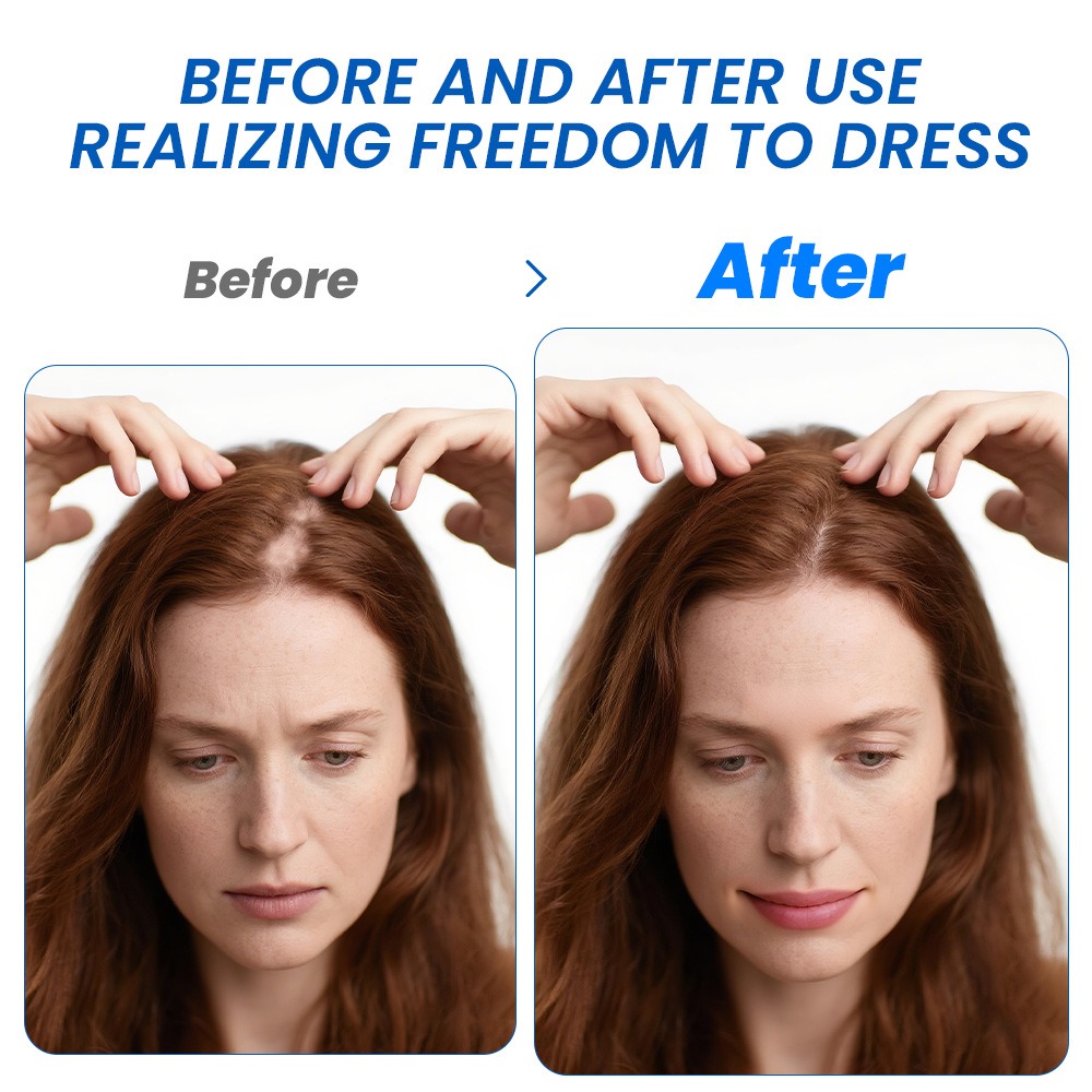 Алопеция Спрей для роста волос – обзор и цена Hair Care Cream