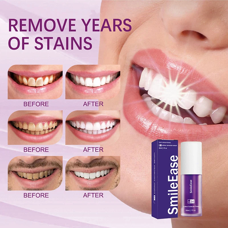 45 мл Smilekit фиолетовый зубн – обзор и цена Purple Toning Shampoo