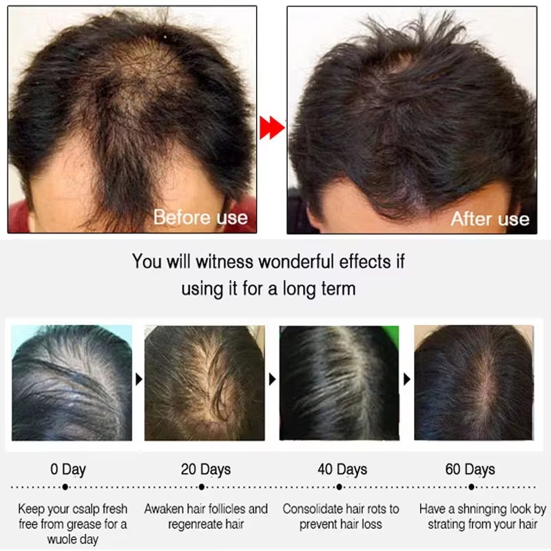 Спрей для быстрого роста волос – обзор и цена Hair Care Nature
