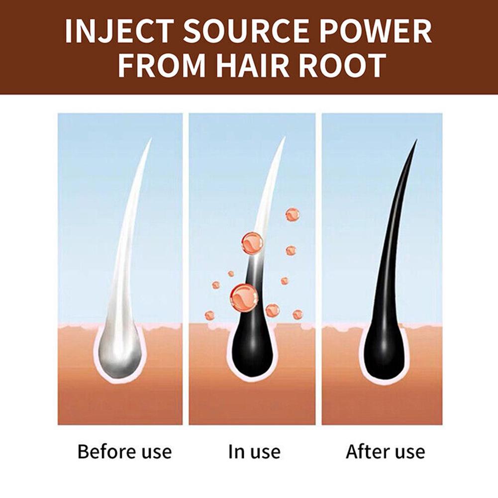 Натуральное мыло ручной работы – обзор и цена Hair Care Dandruff